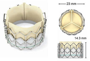 tavr-device.jpg