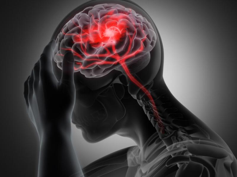 Traumatic Brain Injury Signs You Need to Know