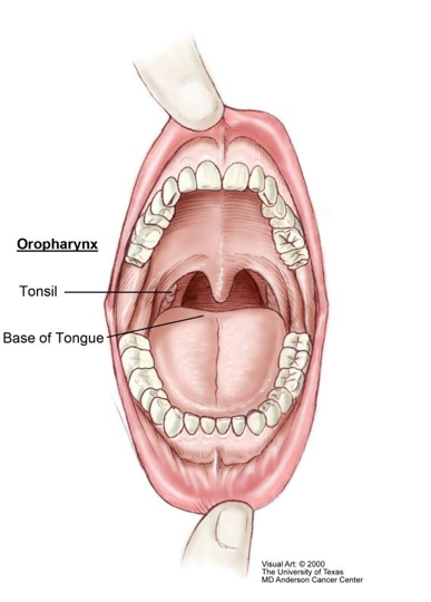 Oropharyngeal cancer hpv.