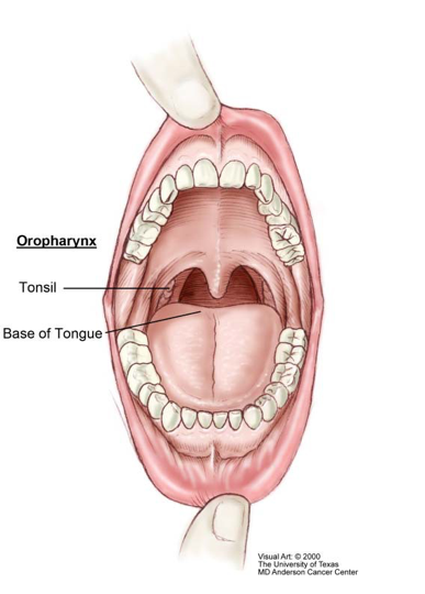 hpv cancer back of throat)