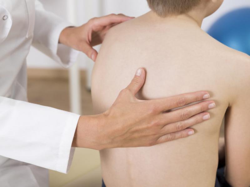 What Are the Causes of Scoliosis: Prevention in Children